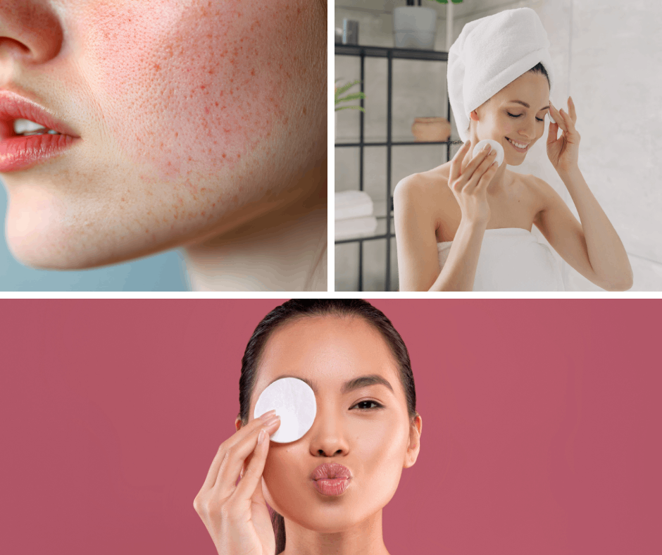 Micelární voda — pro všechny typy pleti